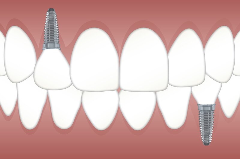 Predental - Clinica dentara sector 6