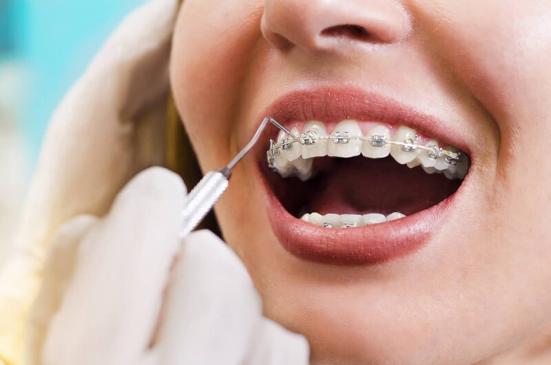 Predental - Clinica dentara sector 6