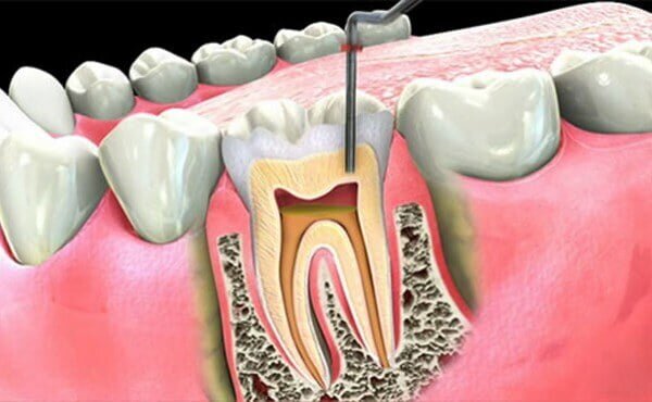 Predental - Clinica dentara sector 6