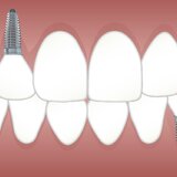 Predental - Clinica dentara sector 6